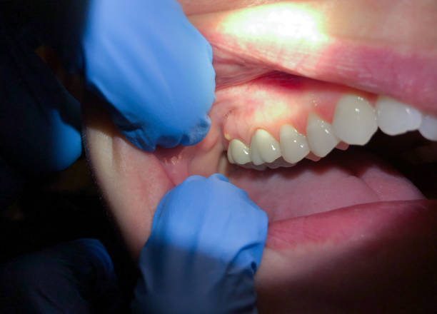 Best Emergency Treatment for Jaw Pain or Injury in Boulder, MT